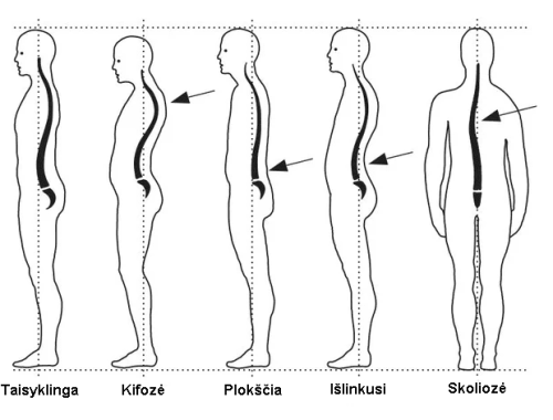 Taisyklinga laikysena